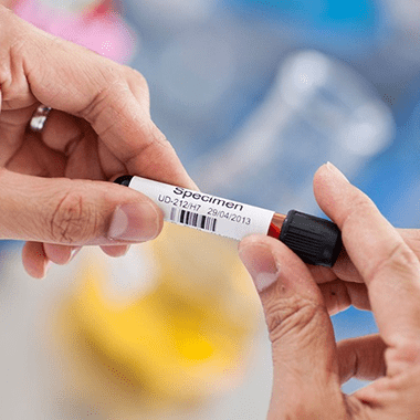 A person holding a blood specimen sample with a label applied that represents Brother Label Printers for Healthcare businesses like Awanui Labs